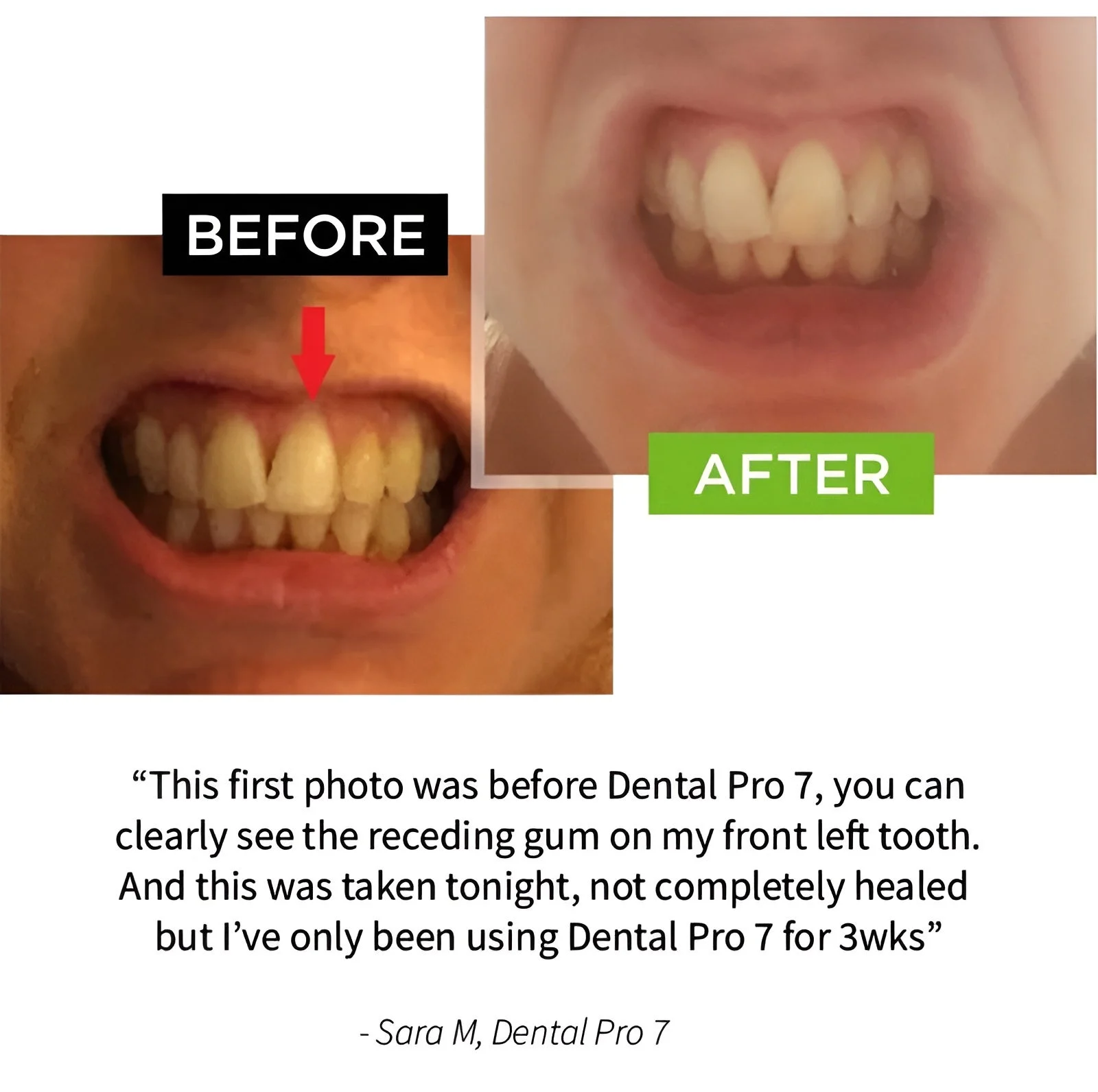 Dental Pro 7 — Official Website | DentalPro7.com